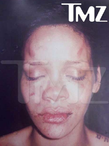 chris brown and rihanna pictures leaked. taken after Chris Brown